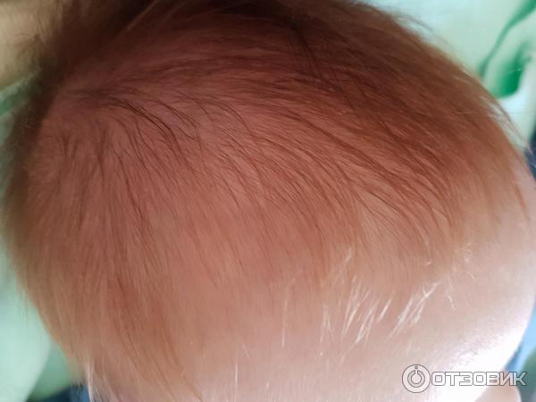Отзыв о Пенка-шампунь Mustela bebe для новорожденных против себорейных ...