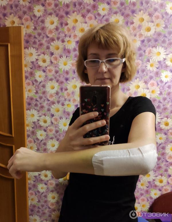 Отзыв о Пластырь Пауль Хартманн Cosmopor | Очень выручил после операции.