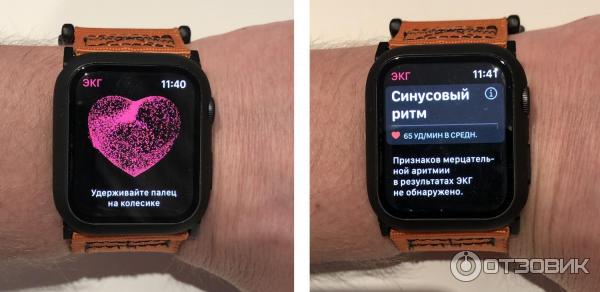 Apple Watch 38 мм на женской руке