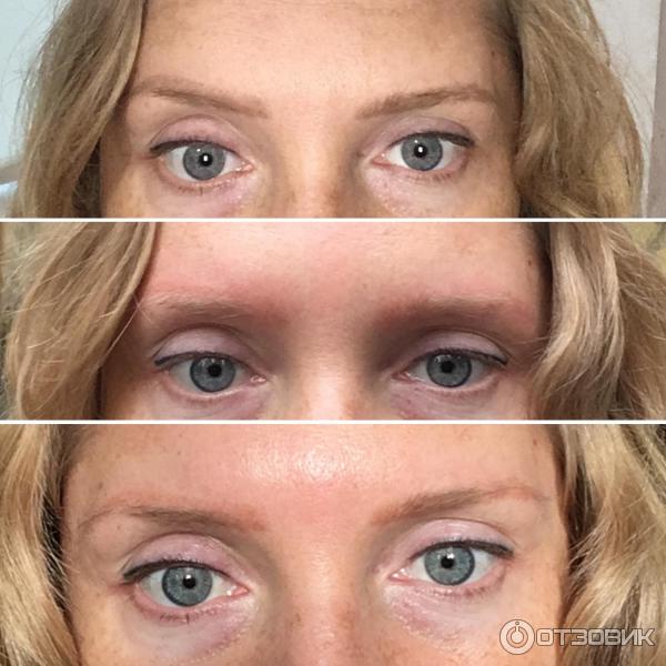 Отзыв о Лазерное удаление татуажа | СПАСЕНИЕ! Идеальное средство!