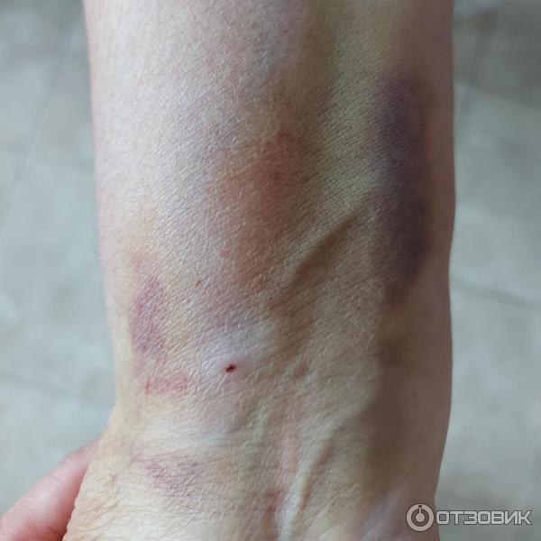 Отзыв о Коронарография | Серьезная диагностическая процедура, которая ...