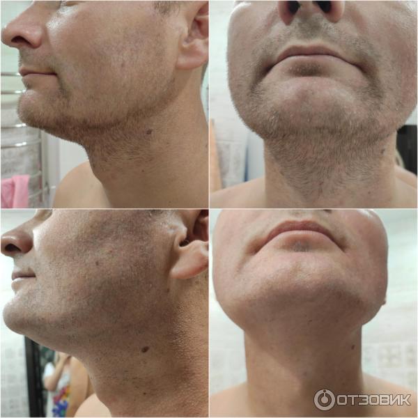 Электробритва Xiaomi Mi Electric Shaver S500 фото
