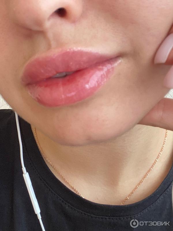 Divage elixir lip oil. Губа.